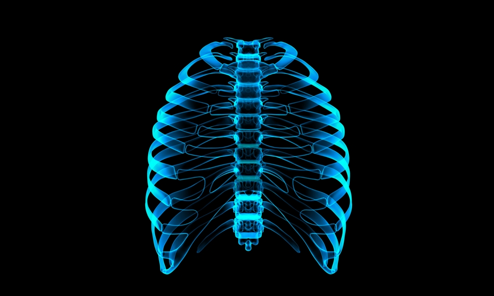 3D Printed Prosthetics: Reproducing a Rib Cage