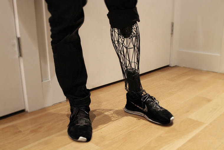 http://www.ufunk.net/en/tech/exo-prosthetic-leg/