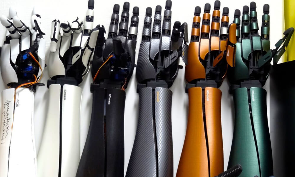 How 3D printed robotic arms could help you