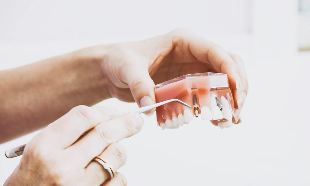3D printing solving denture problem… in prison?