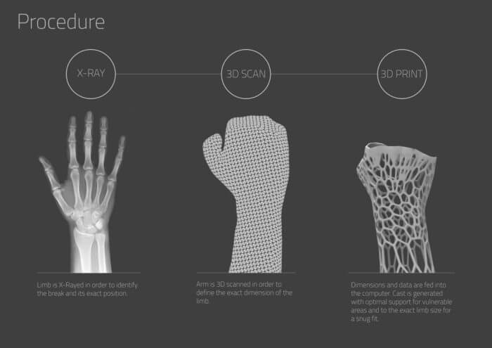 https://www.arch2o.com/new-way-heal-broken-bones-3d-printed-cast-3d-molds-exoskeletal/
