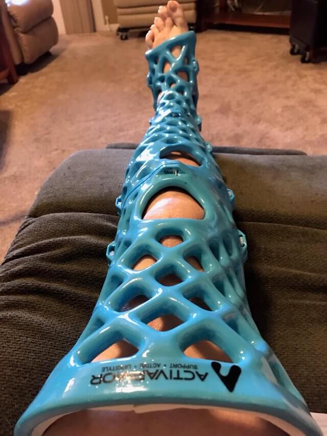 https://www.reddit.com/r/pics/comments/ahhseb/my_moms_3d_printed_cast_she_can_take_a_shower/